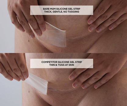 Silicone Gel Scar Strips: 3 STRIPS